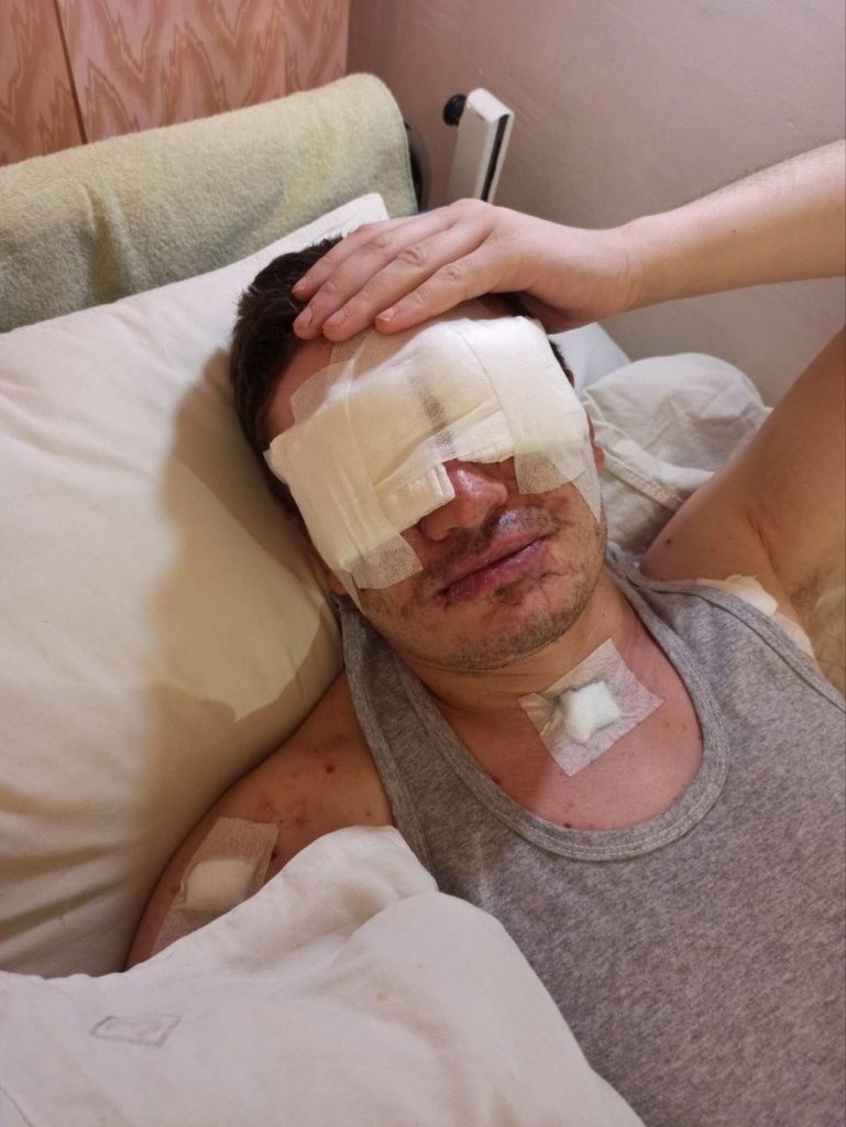Віталій Верес вийшов з коми і дізнався, що повністю втратив зір внаслідок отриманого поранення. Фото надав Віталій